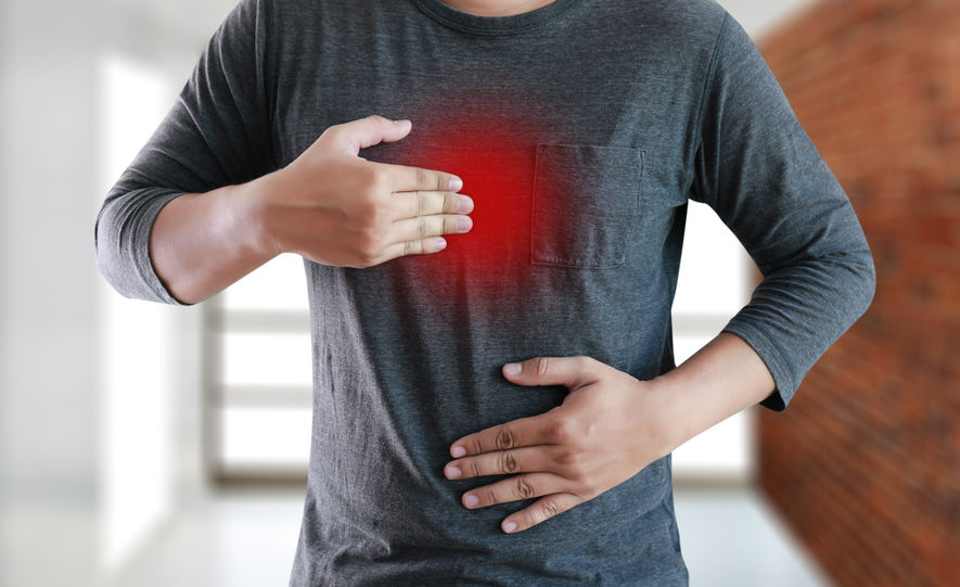 How Best To Treat Acid Reflux